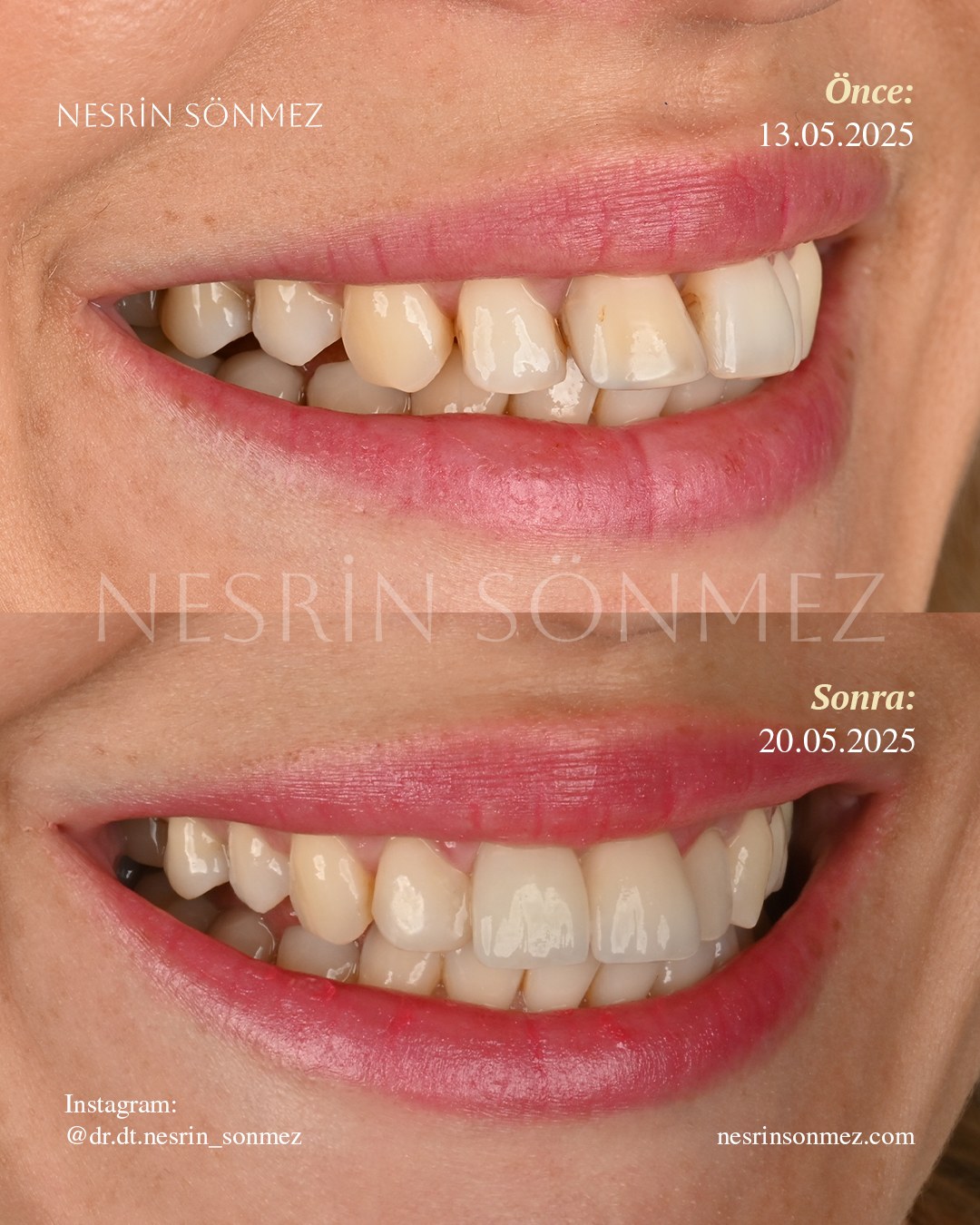 Case 21 before and after — view 2