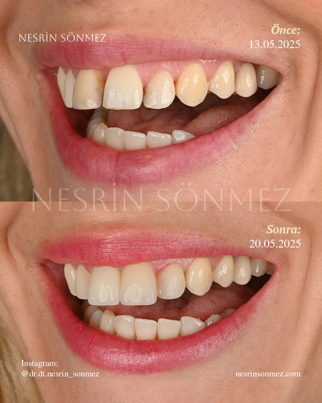 Case 21 before and after — view 3