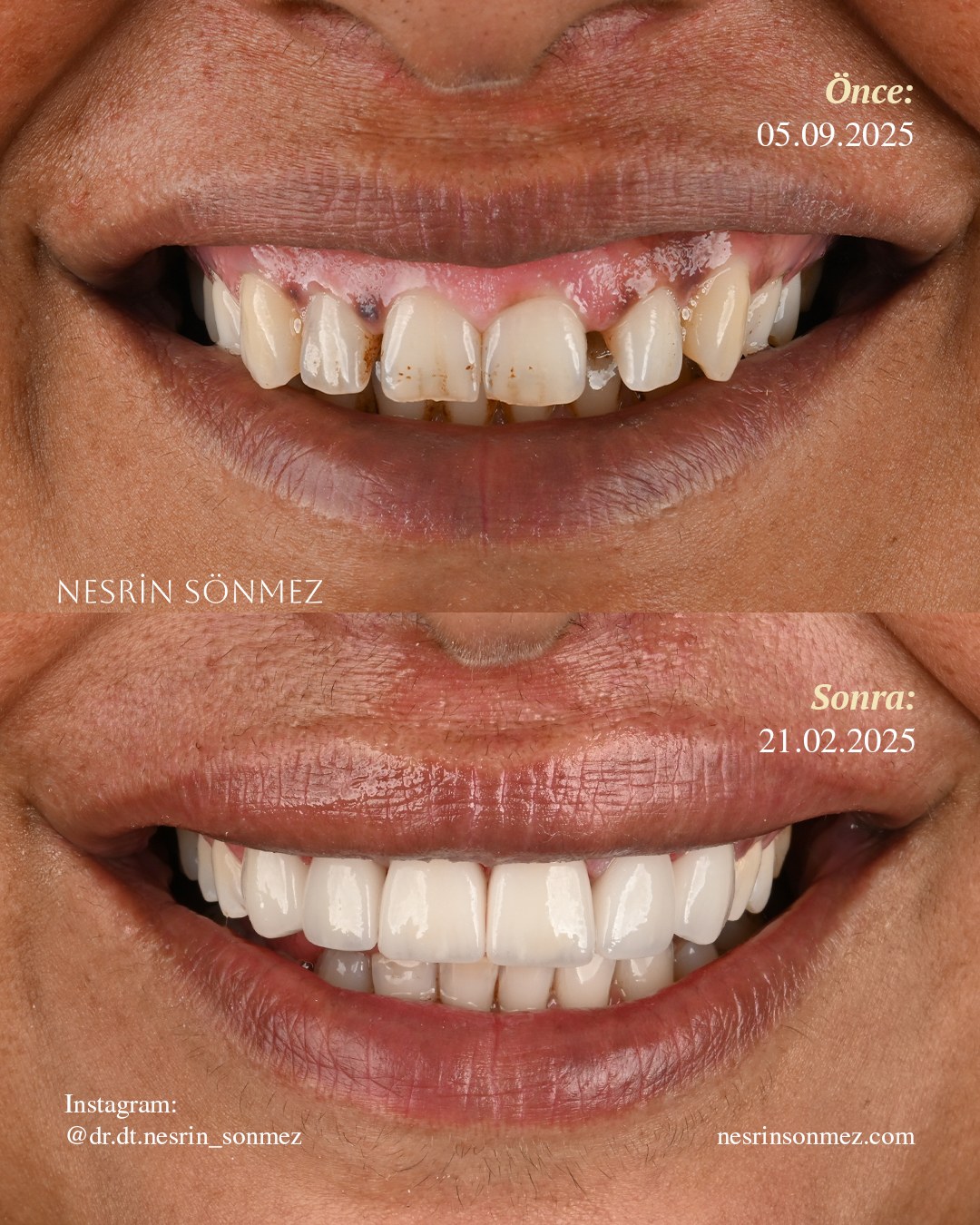 Case 22 before and after — view 1
