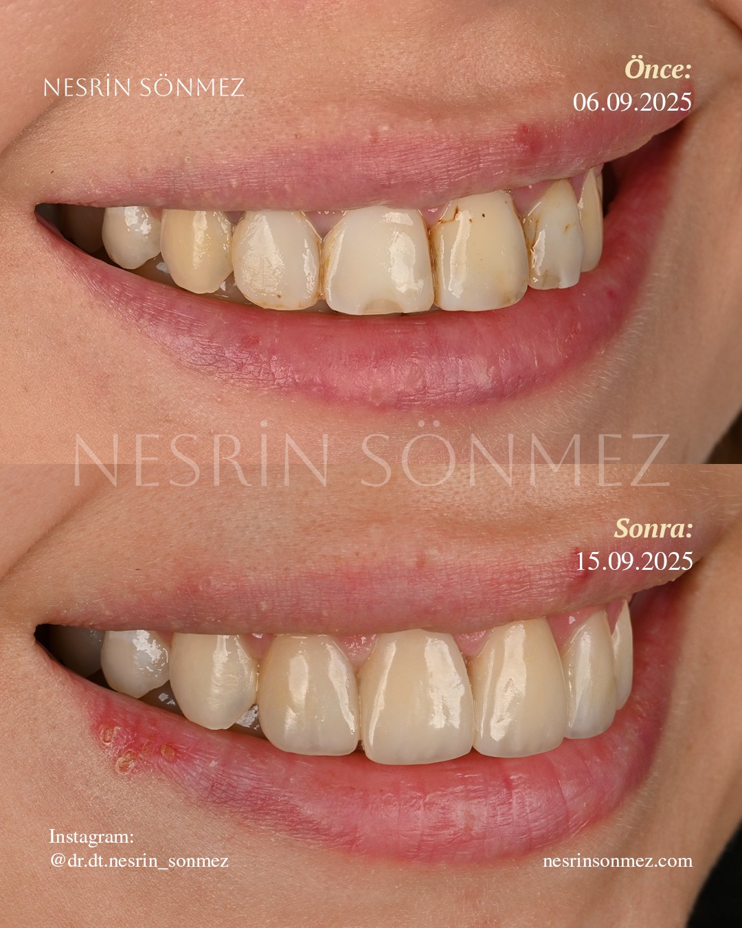 Case 23 before and after — view 2