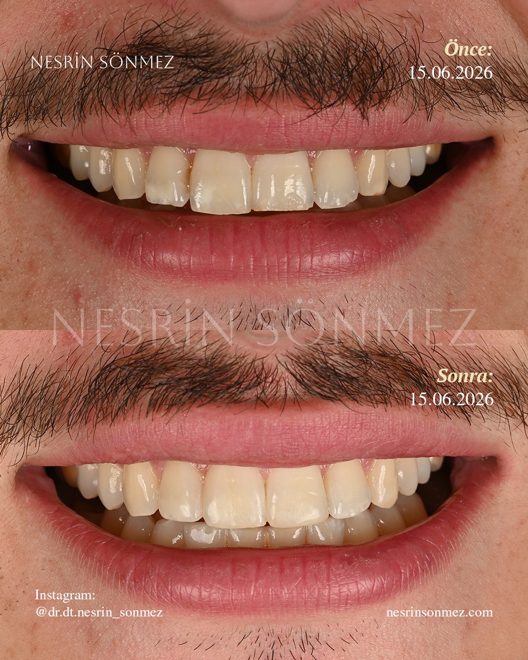 Case 24 before and after — view 1