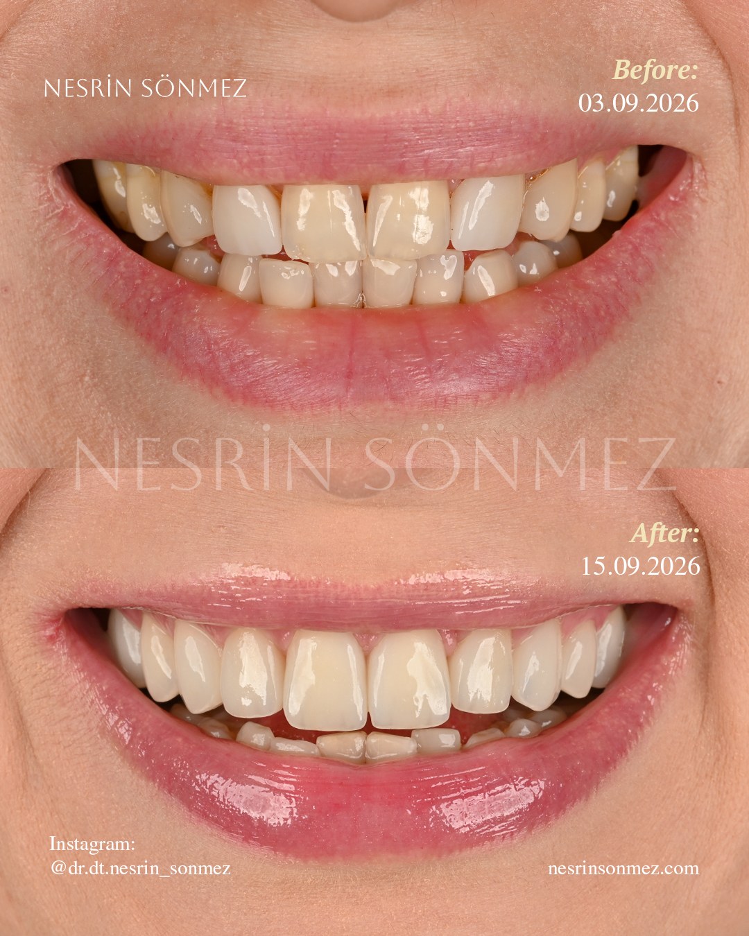Case 30 before and after — view 1