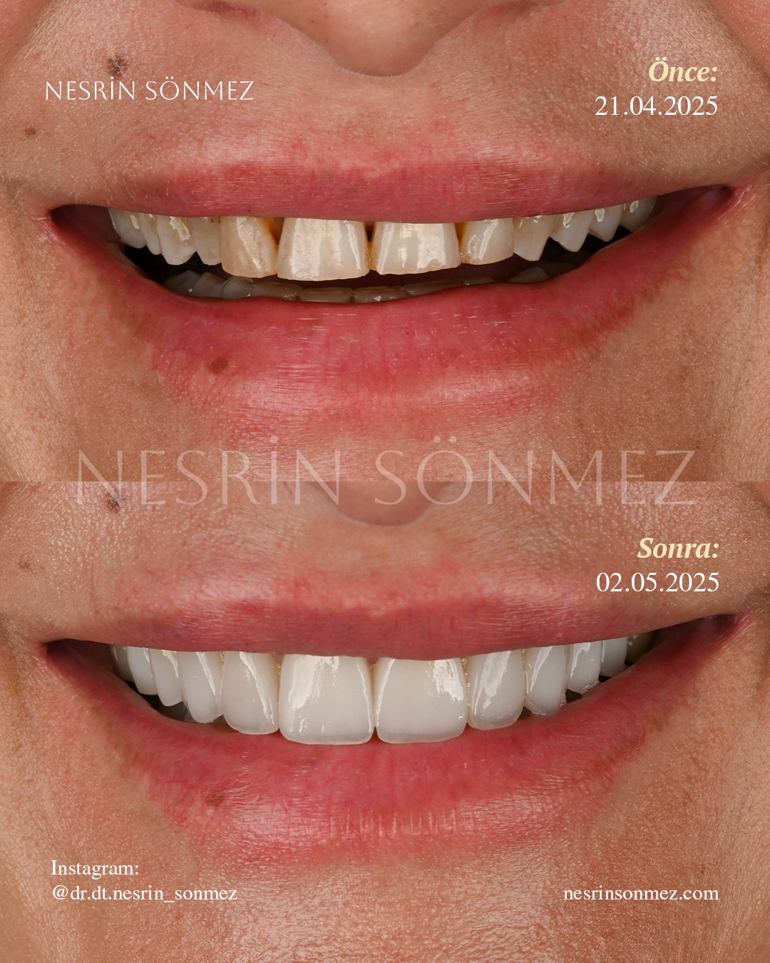 Case 26 before and after — view 1