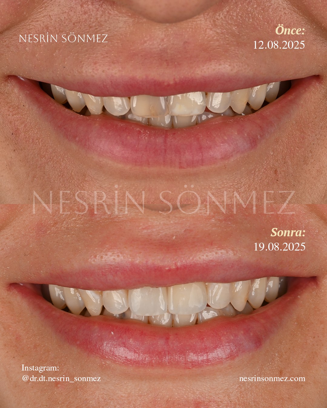 Case 27 before and after — view 1