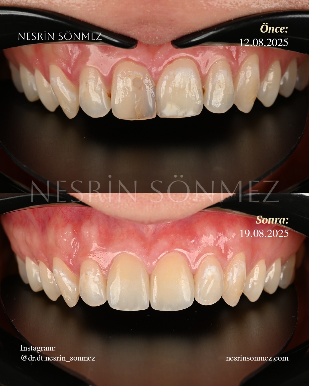 Case 27 before and after — view 2