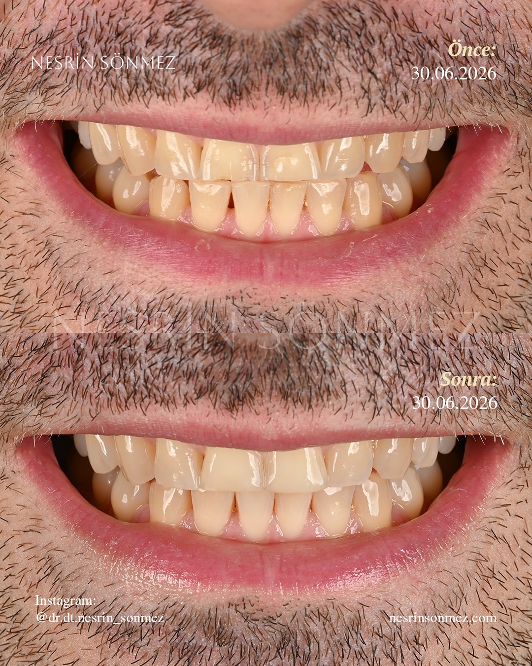 Case 28 before and after — view 1