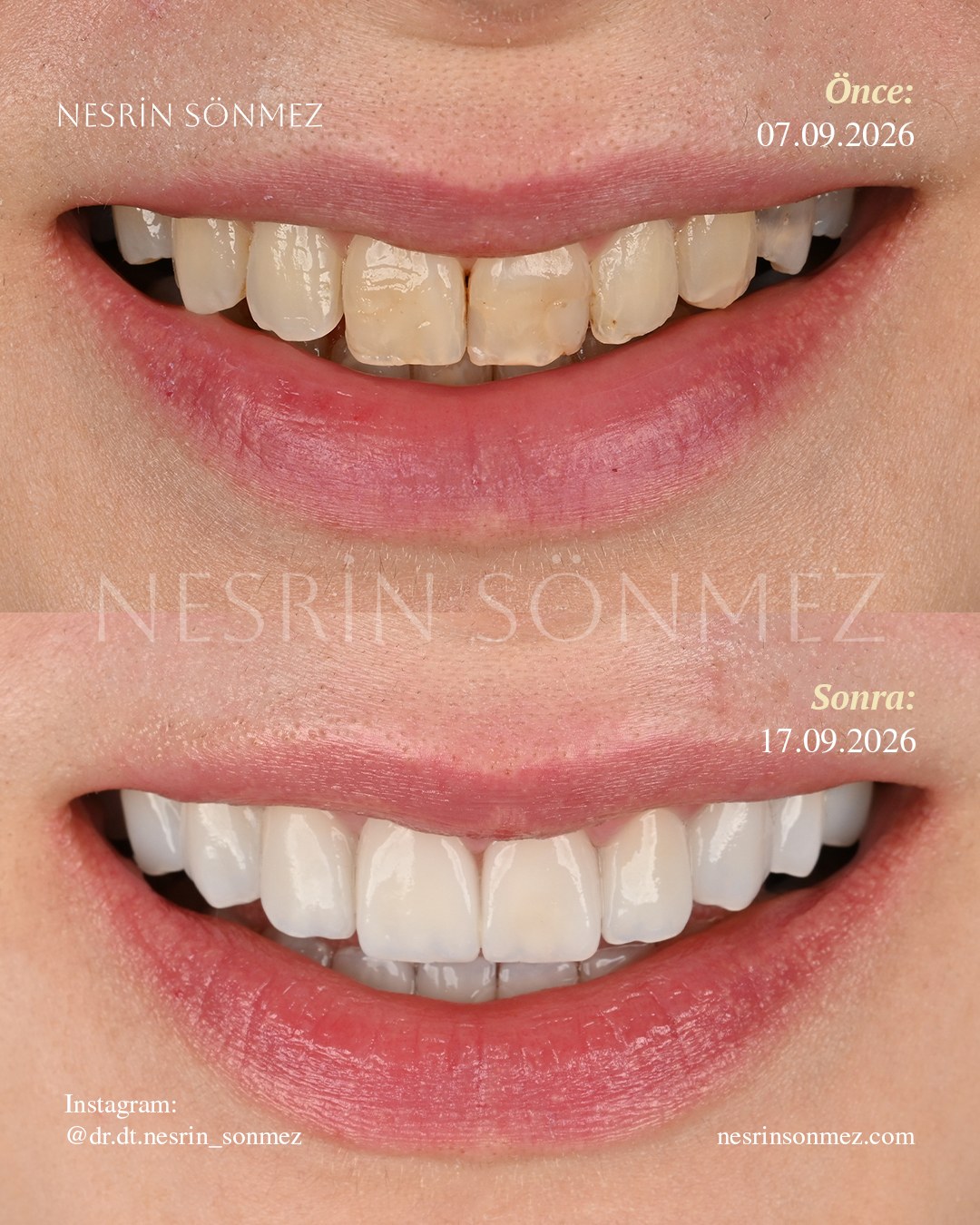 Case 29 before and after — view 1