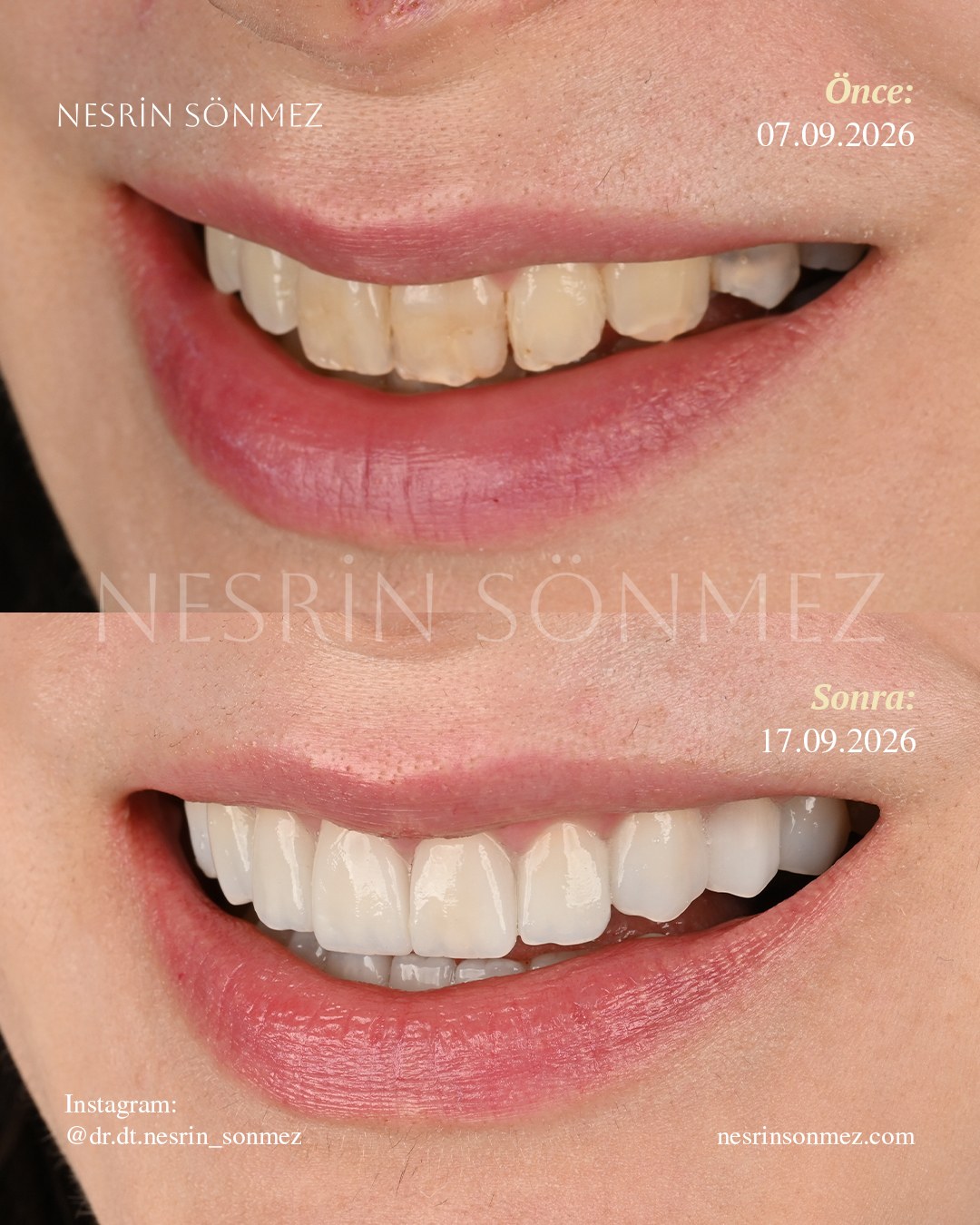 Case 29 before and after — view 2