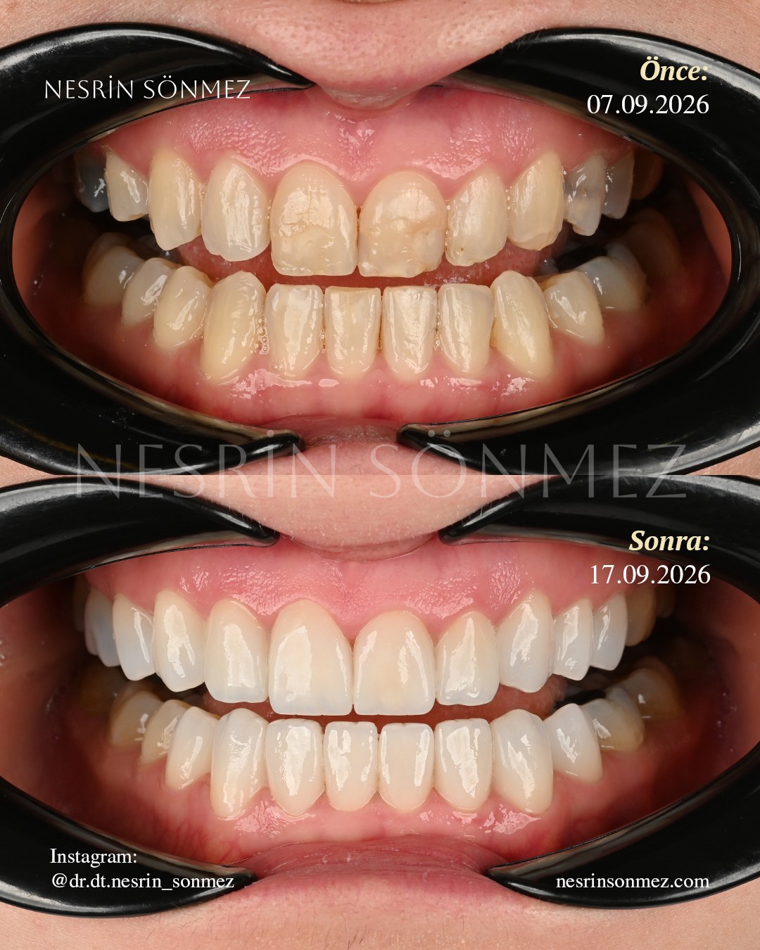 Case 29 before and after — view 3