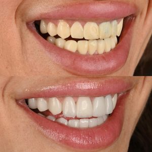 520734865_18521465374013771_968058462211258391_n